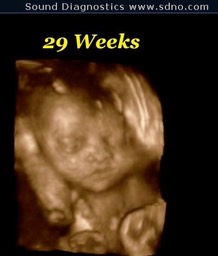 29wk4