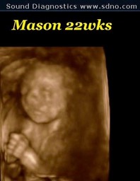 mason22w3