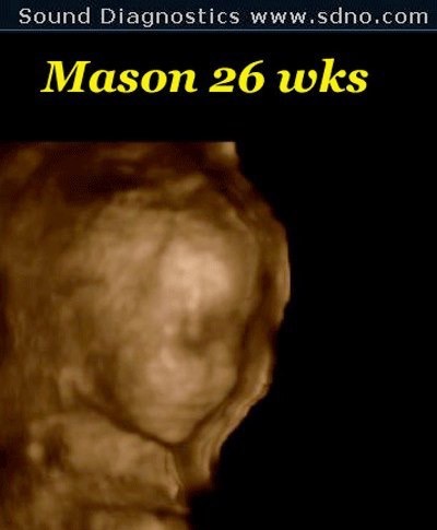 mason26w2