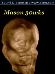 mason30wk5