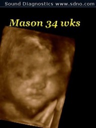 mason34wk2